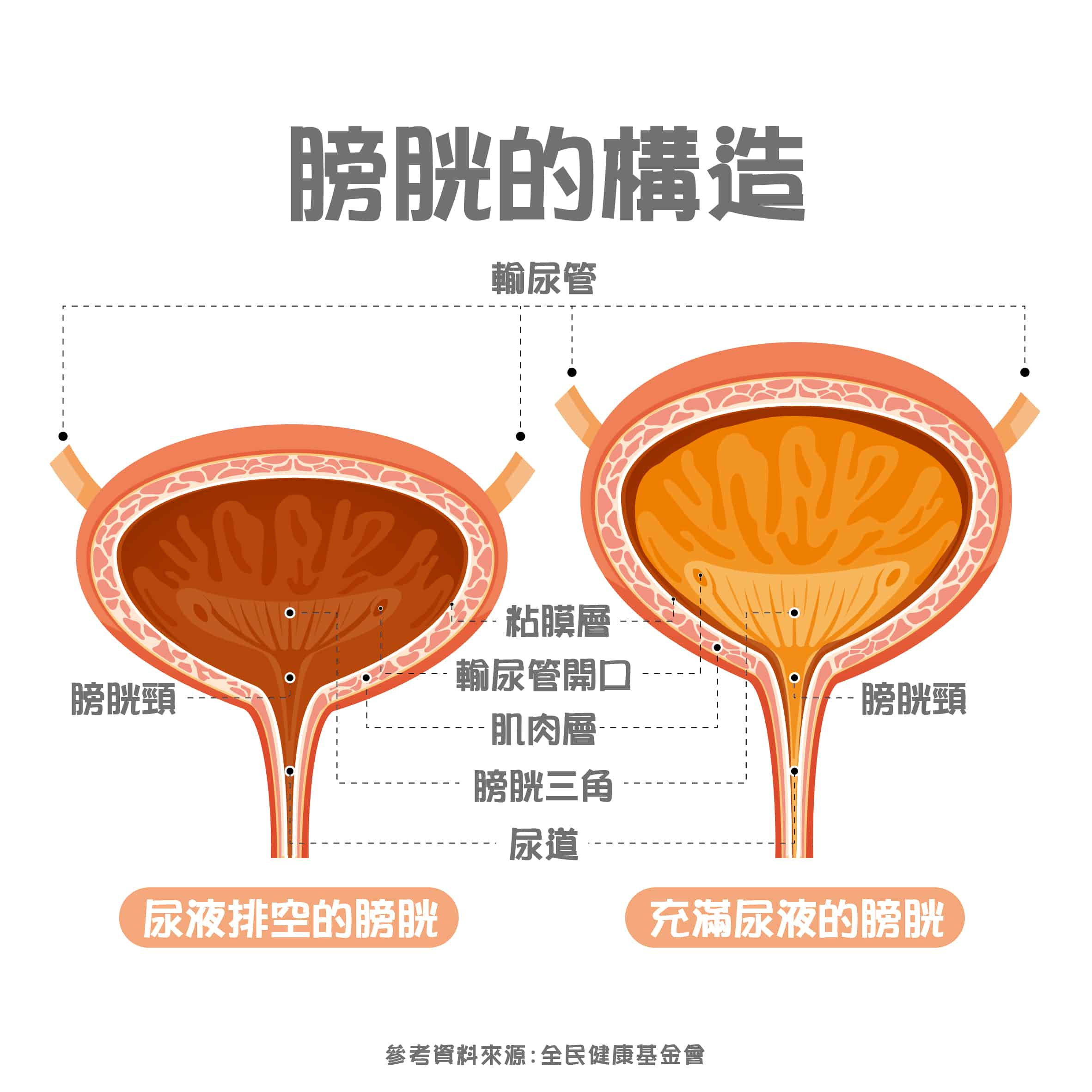 認識膀胱：位置、構造、功能、保養照顧