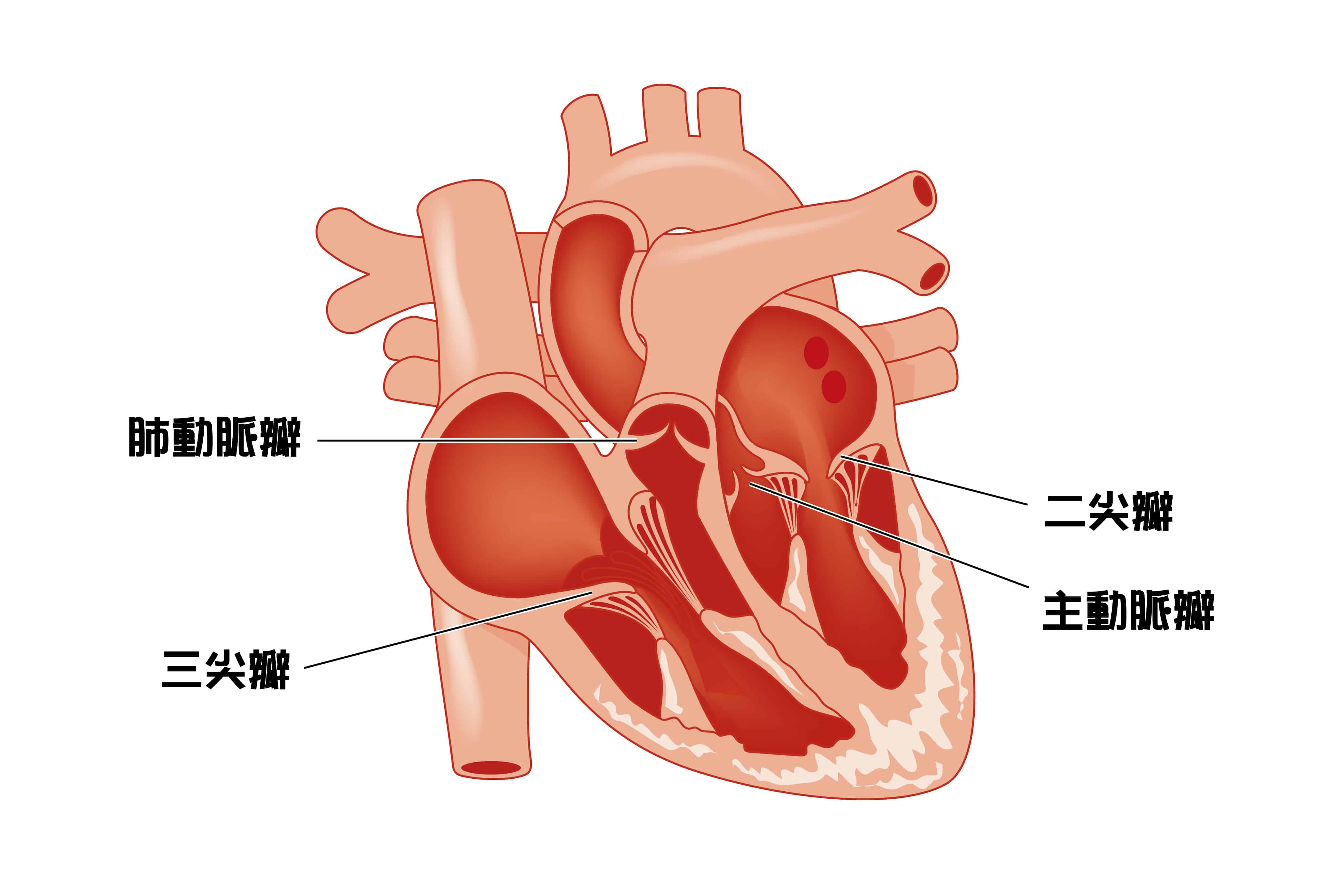 瓣膜性心臟病