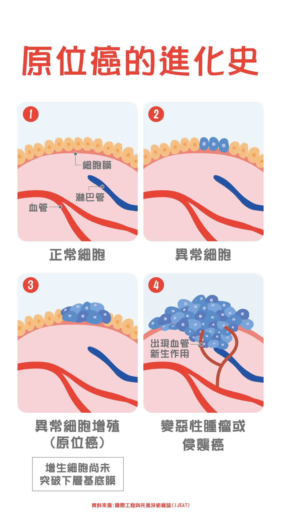 原位癌是什麼？剖析癌症進化史