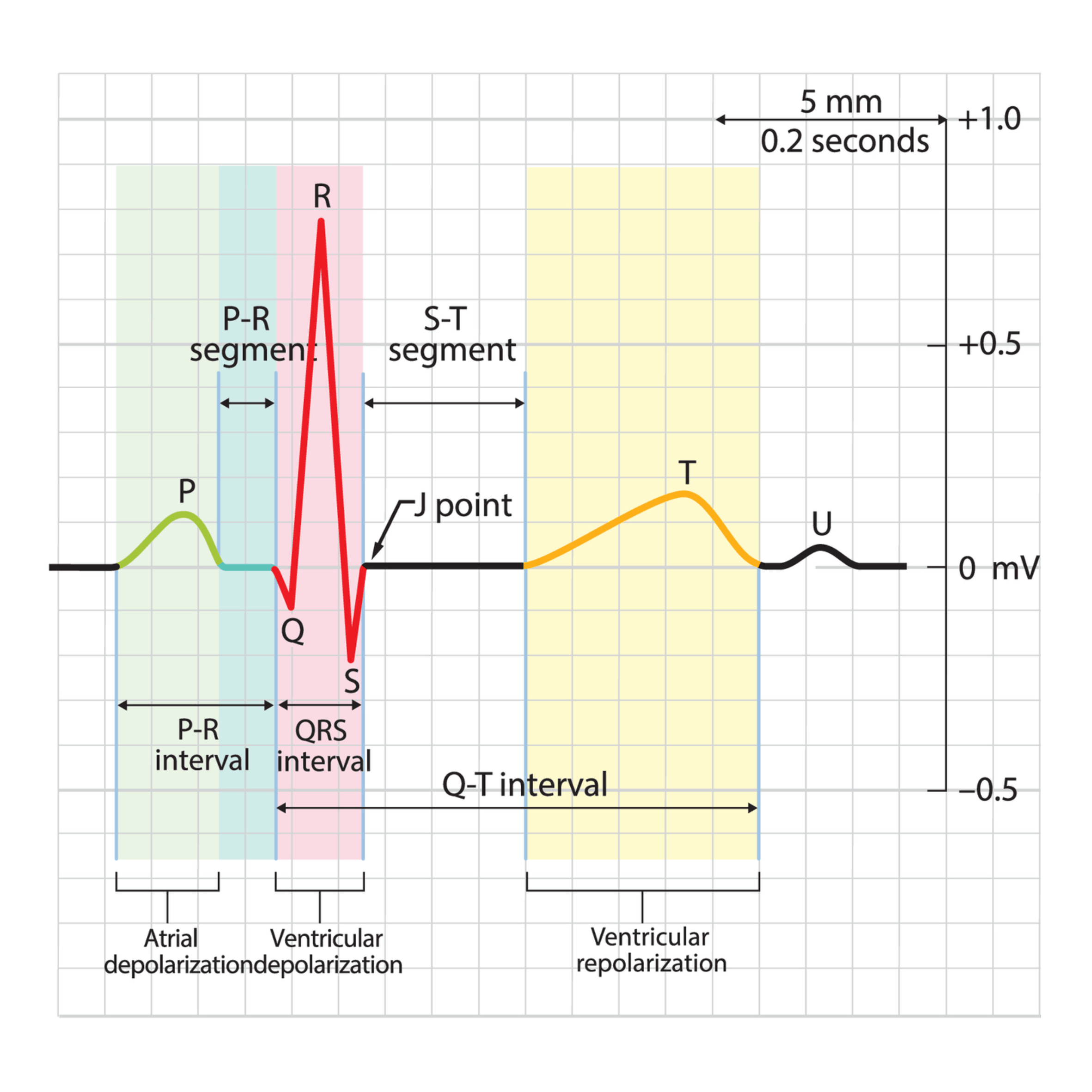 心電圖怎麼看？波型判讀及檢查流程介紹