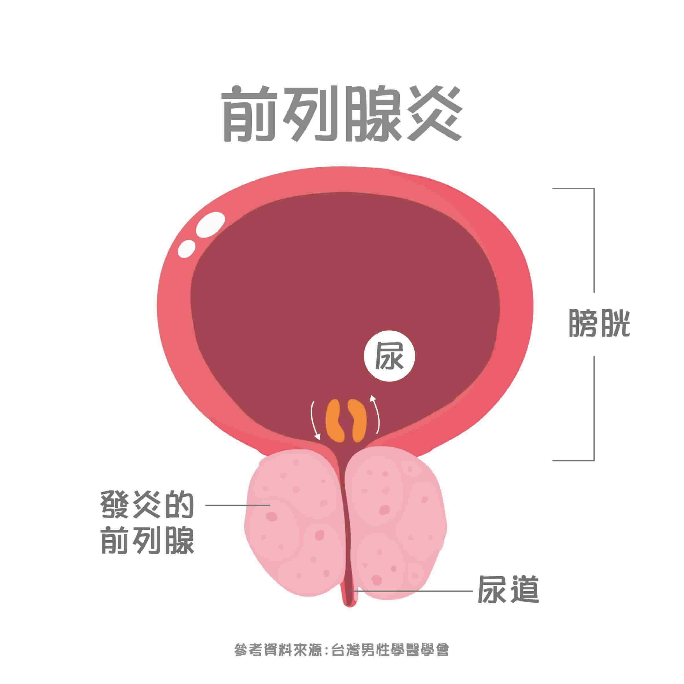 攝護腺是什麼？前列腺位置在哪？攝護腺功能、疾病及檢查詳解