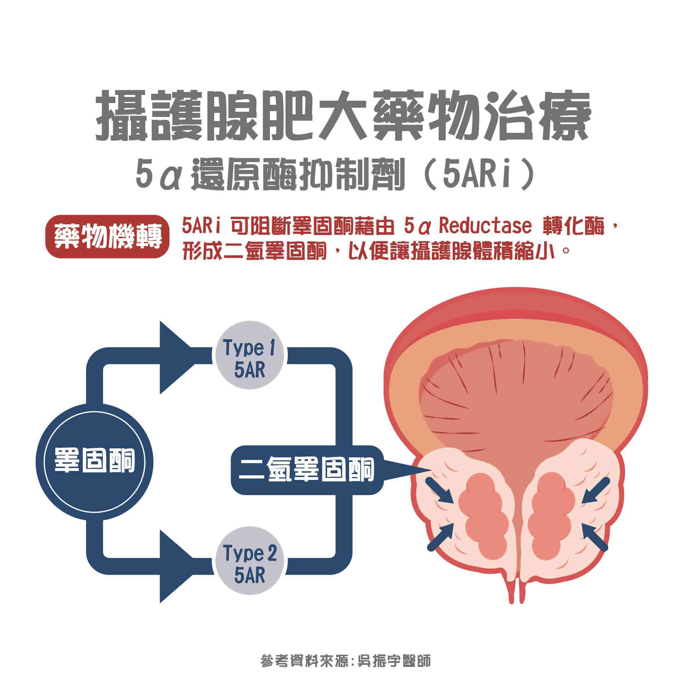 攝護腺肥大可靠吃藥改善？良性攝護腺肥大治療藥物介紹