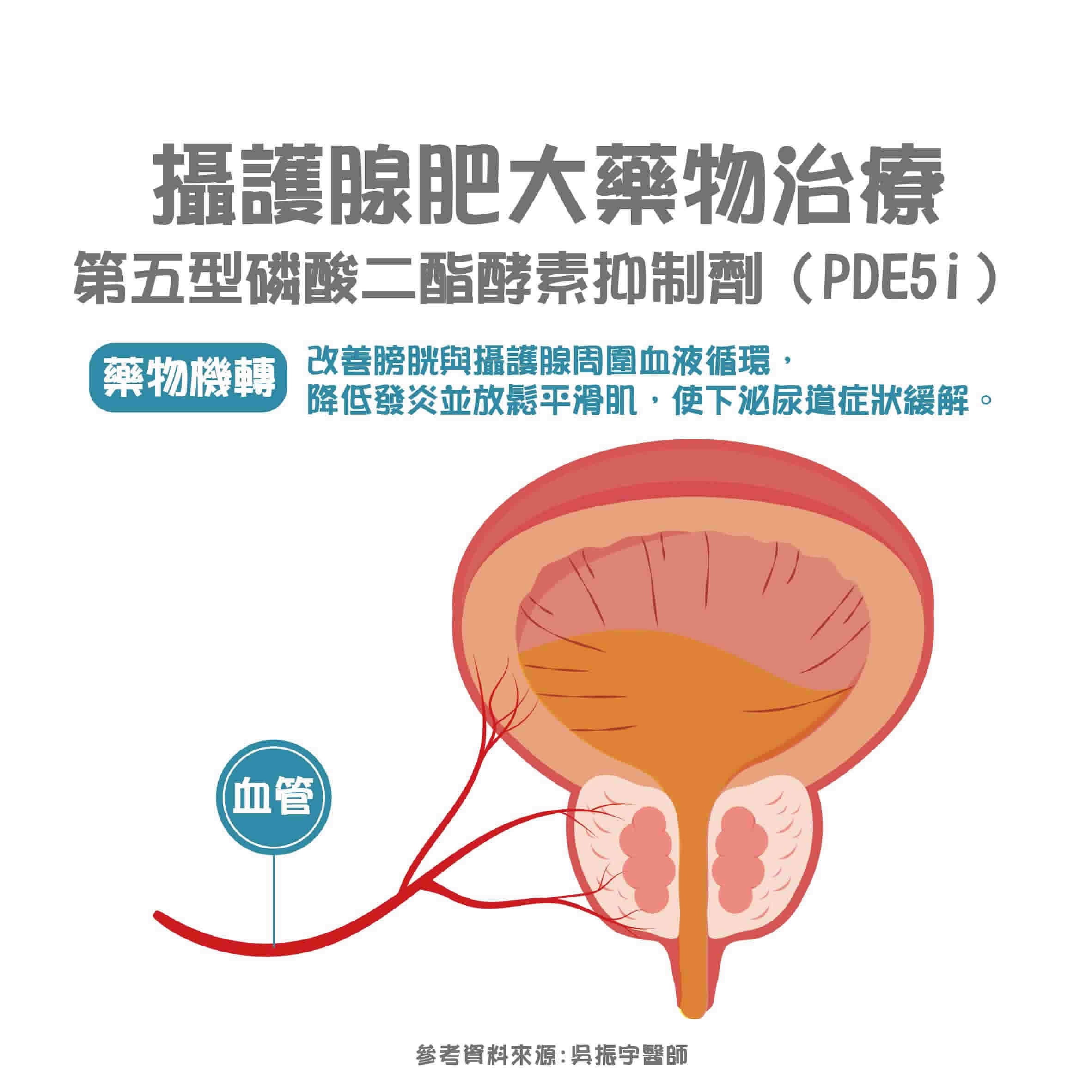 攝護腺肥大可靠吃藥改善？良性攝護腺肥大治療藥物介紹