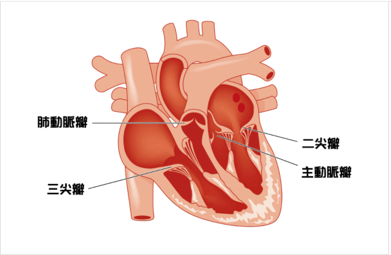 無症狀卻致死率高？了解主動脈瓣狹窄9大風險因子、症狀和治療方式