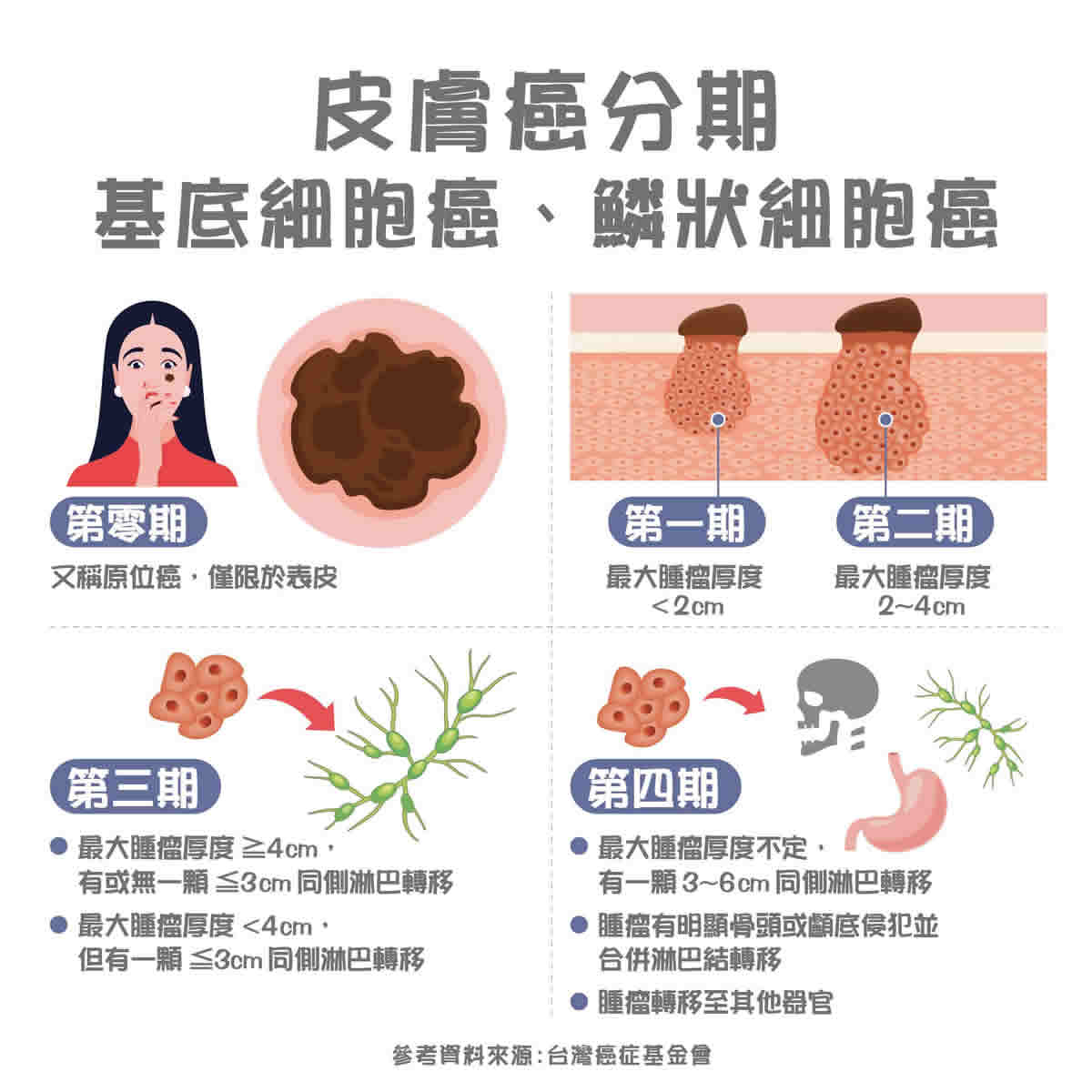 皮膚長痣、長斑是皮膚癌前兆？皮膚癌初期4大症狀快確認、檢測、9大皮膚癌風險全解析