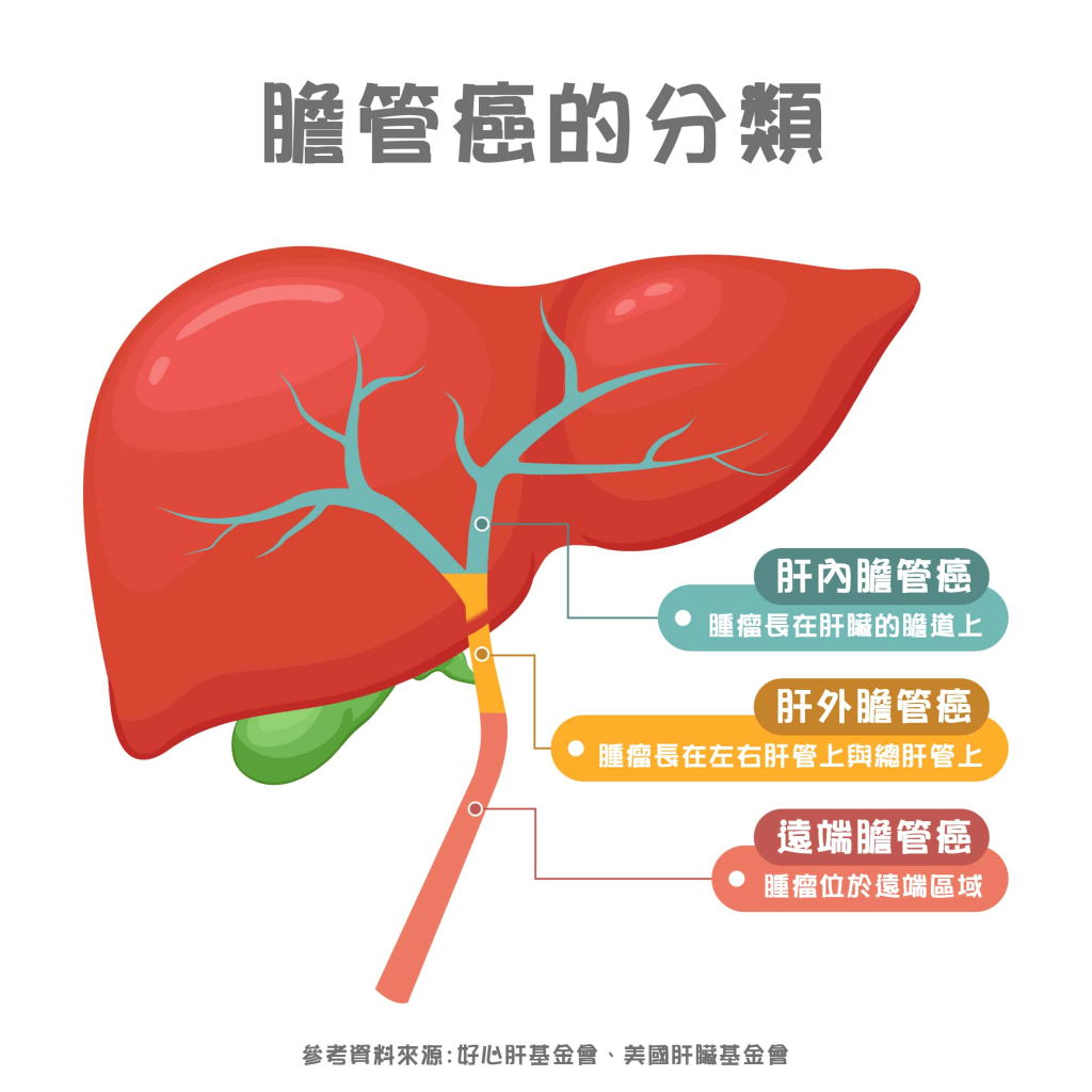 注意膽管癌初期3症狀！膽管癌治療新藥、存活率一次看