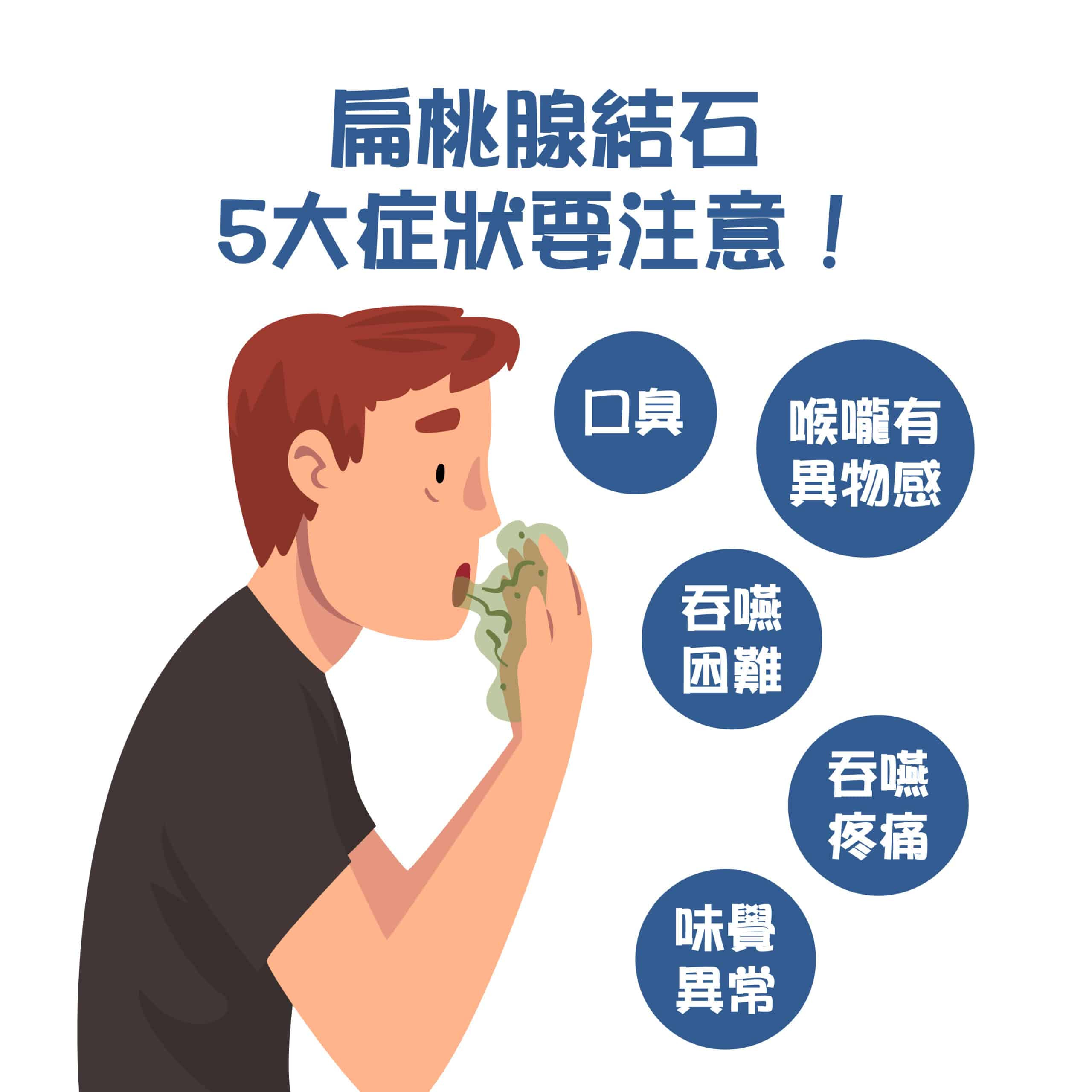 扁桃腺結石引口臭！3撇步預防扁桃腺結石，讓你喉嚨不卡卡