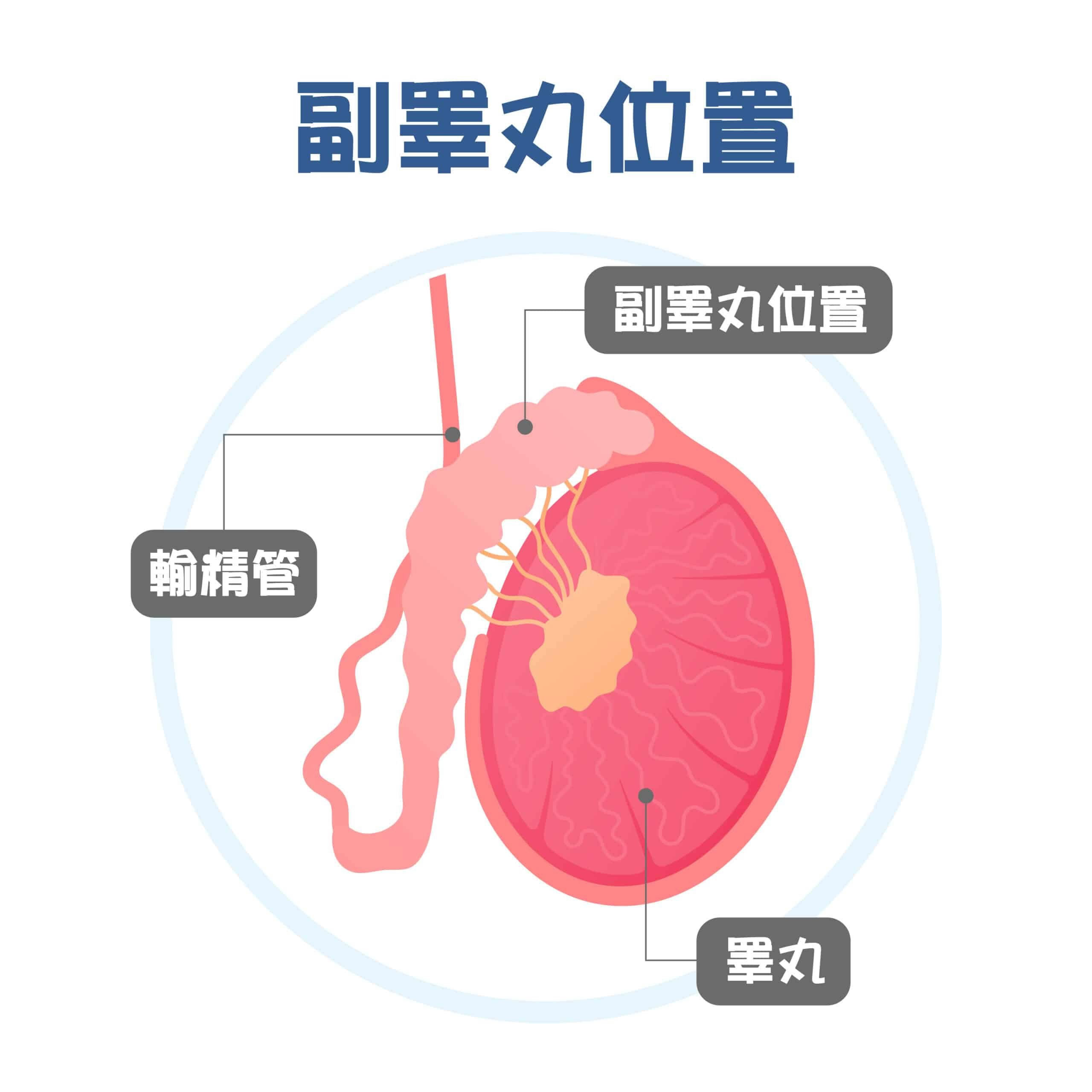 副睪丸發炎「蛋蛋」痛？預防副睪丸炎，安全性行為很重要！