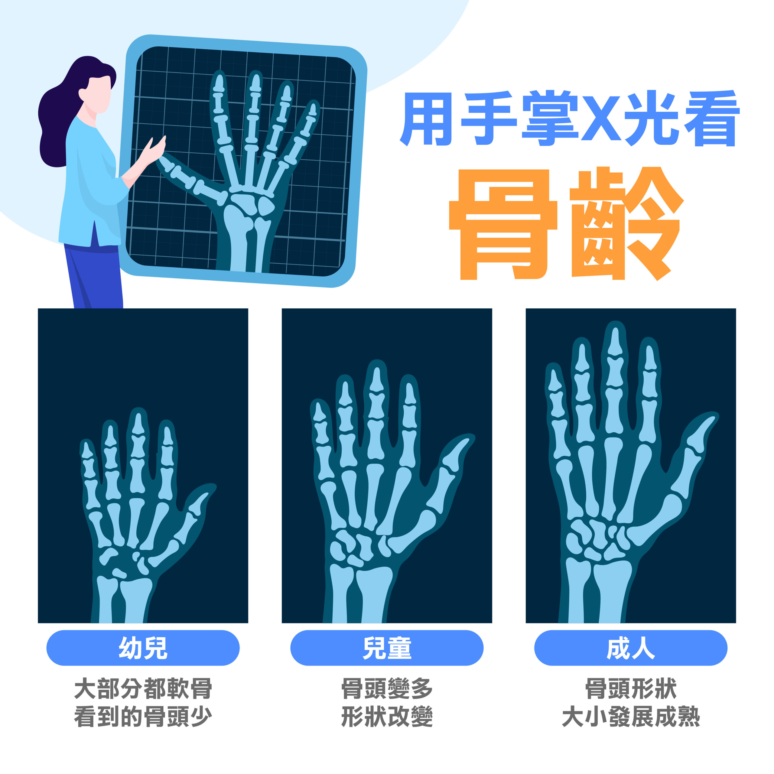 骨齡是什麼？骨齡落後、超前長不高？認識骨齡的功用、檢查方法