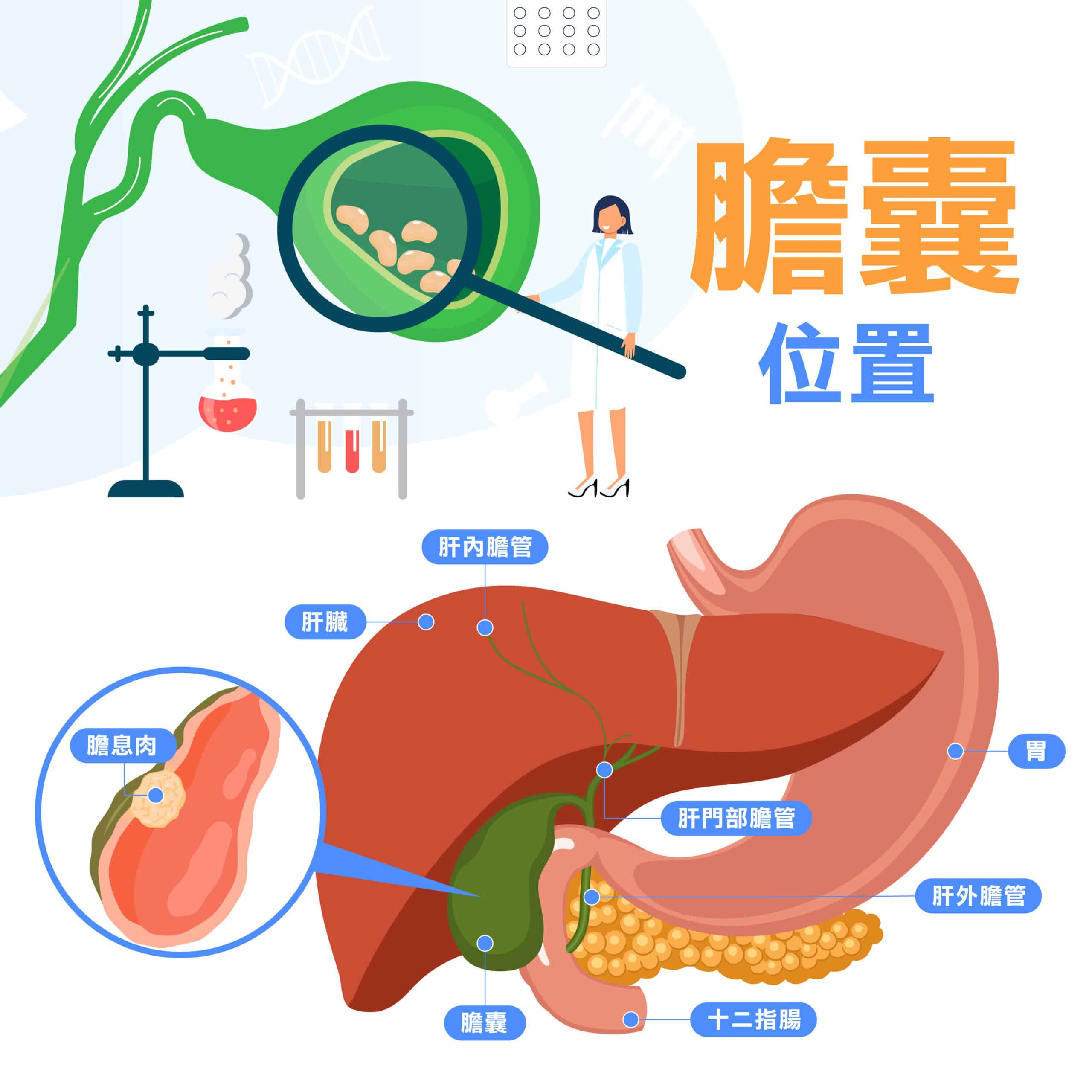 膽長息肉怎麼辦？要切除嗎？膽囊息肉原因、種類及症狀解析