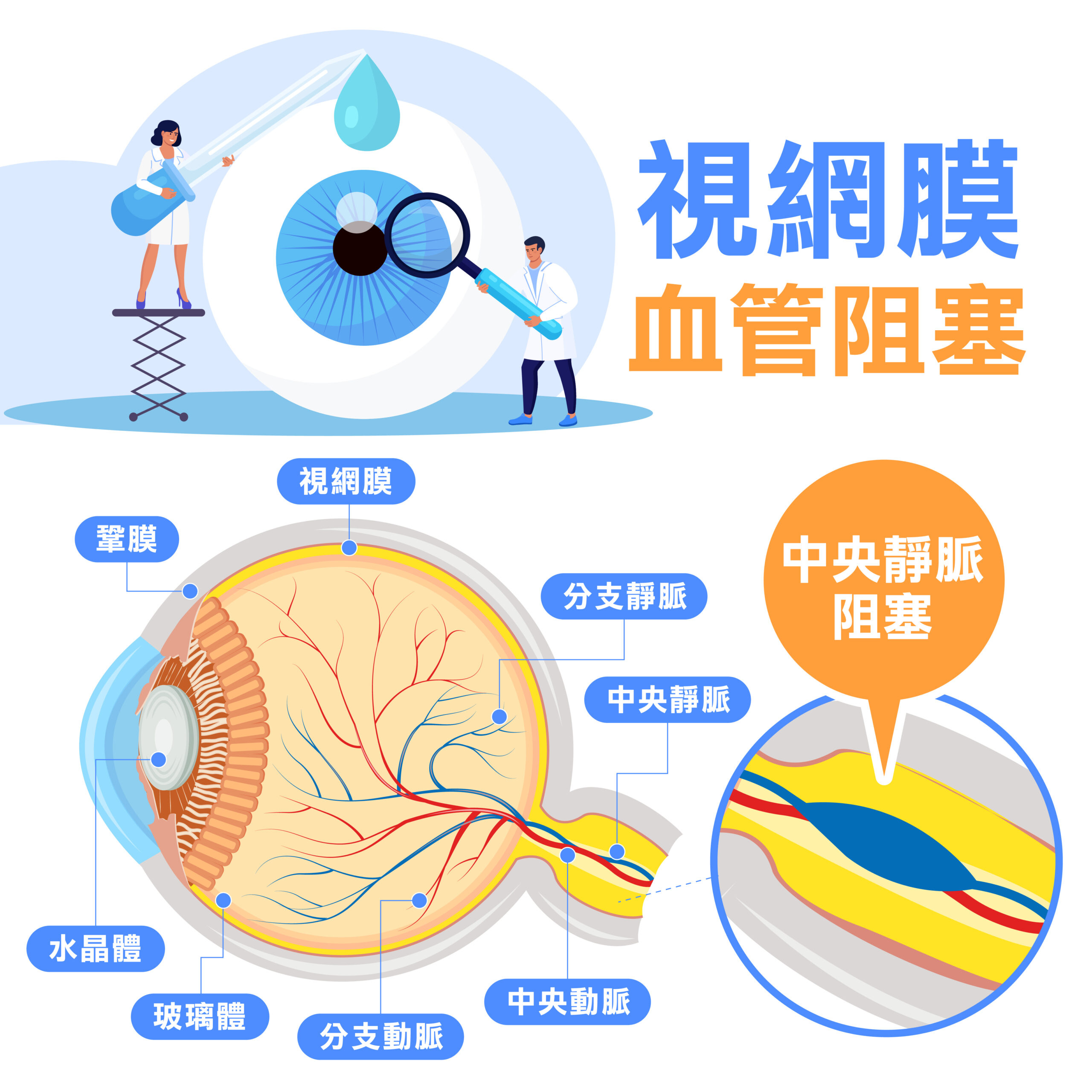 眼睛中風怎麼辦？會好嗎？眼中風前兆、症狀、治療一次答