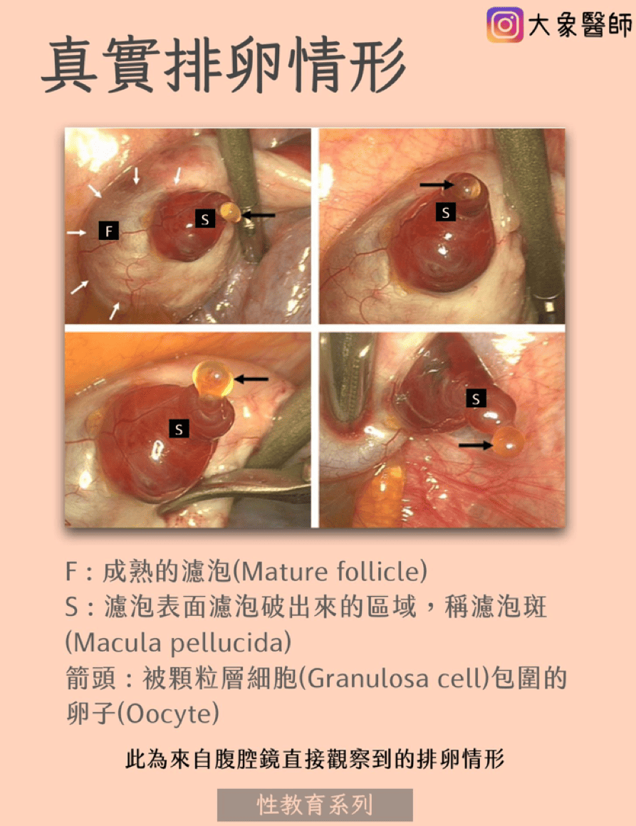 月經不正常必看！何時需要就醫？5大「自我檢測」問題一次看